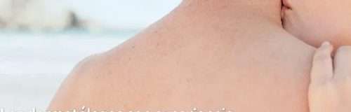 Novartis: campaña para Cosentyx