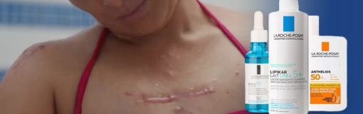 La Roche con campaña, dermo