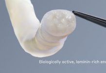 FDA: luz verde para injerto nervioso Axogen Avance