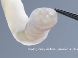 FDA: luz verde para injerto nervioso Axogen Avance