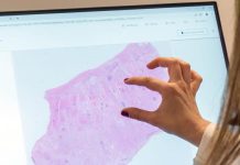 La FDA califica primera IA para ensayos clínicos PathAI AIM-MASH