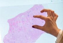 La FDA califica primera IA para ensayos clínicos PathAI AIM-MASH