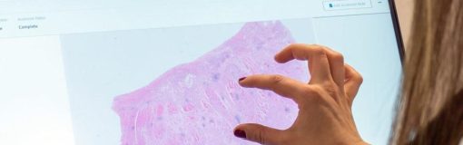 La FDA califica primera IA para ensayos clínicos PathAI AIM-MASH